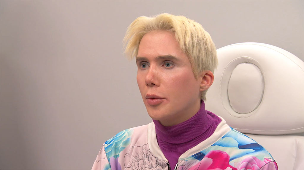 botched oliver bts doctors superfan nose fix popped